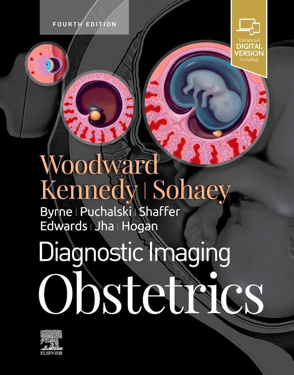 Cover: 9780323793964 | Diagnostic Imaging: Obstetrics | Paula J. Woodward | Buch | Gebunden