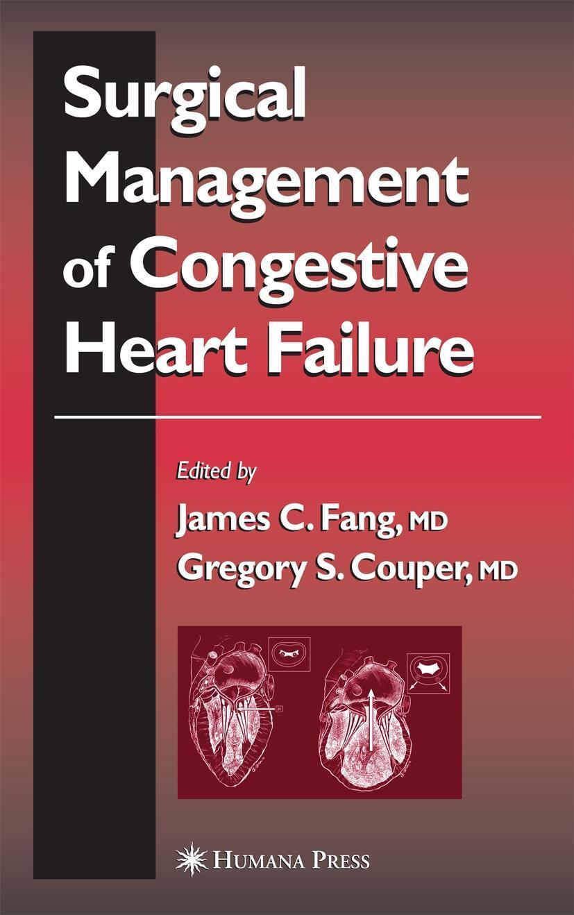 Cover: 9781617373176 | Surgical Management of Congestive Heart Failure | James C Fang (u. a.)
