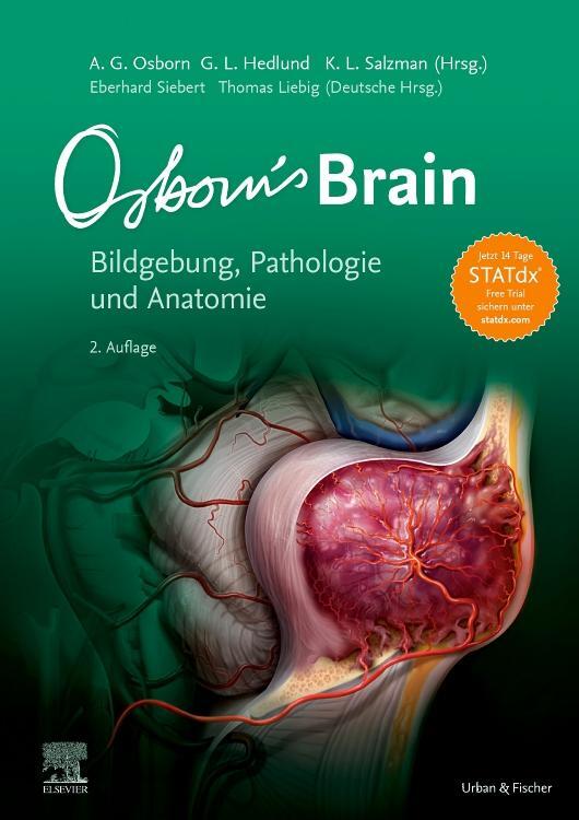 Cover: 9783437210419 | Osborn's Brain | Bildgebung, Pathologie und Anatomie | Osborn (u. a.)