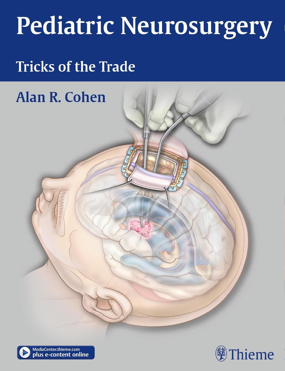 Cover: 9781604068696 | Pediatric Neurosurgery: Tricks of the Trade | Alan R. Cohen | Buch