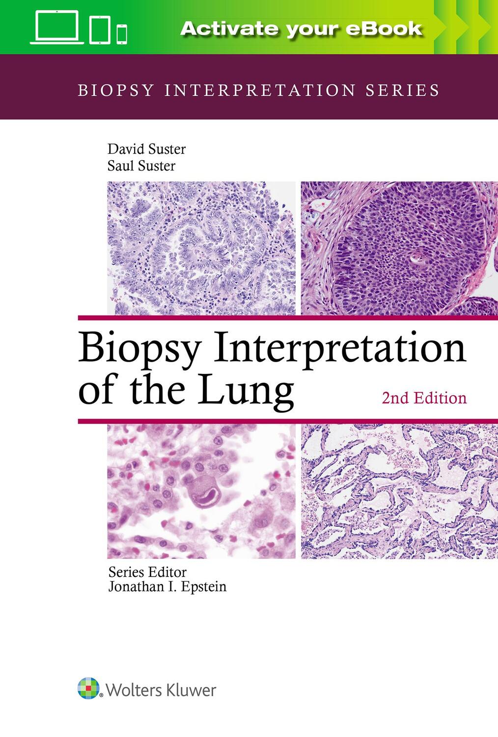 Cover: 9781975136581 | Biopsy Interpretation of the Lung | Biopsy Interpretation Series