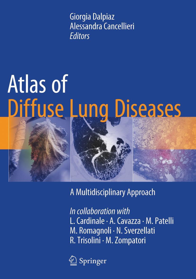 Cover: 9783319427508 | Atlas of Diffuse Lung Diseases | A Multidisciplinary Approach | Buch