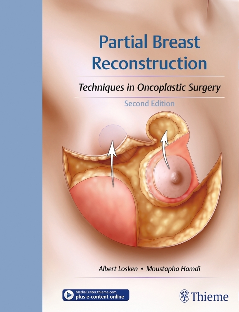 Cover: 9781626236912 | Partial Breast Reconstruction | Albert Losken (u. a.) | Bundle | 2017