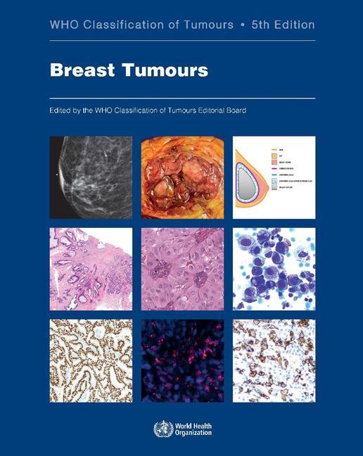 Cover: 9789283245001 | Breast Tumours | Who Classification of Tumours | Board | Taschenbuch