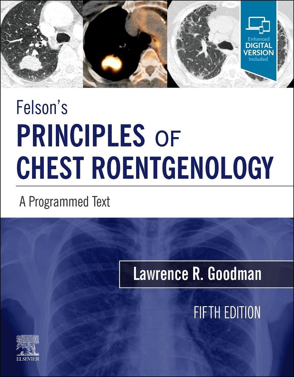 Cover: 9780323625678 | Felson's Principles of Chest Roentgenology, A Programmed Text | Buch