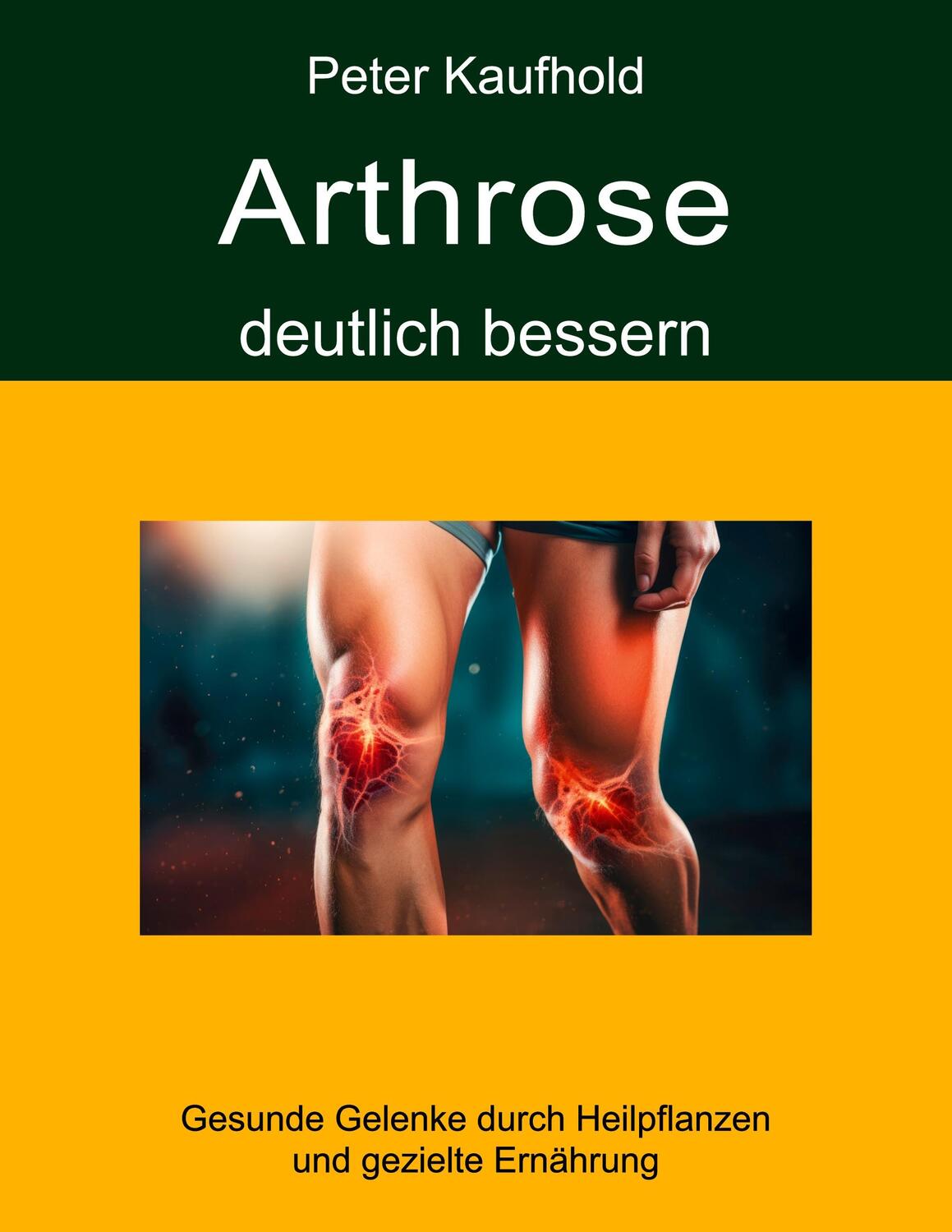 Cover: 9783759733085 | Arthrose deutlich bessern | Peter Kaufhold | Taschenbuch | Paperback