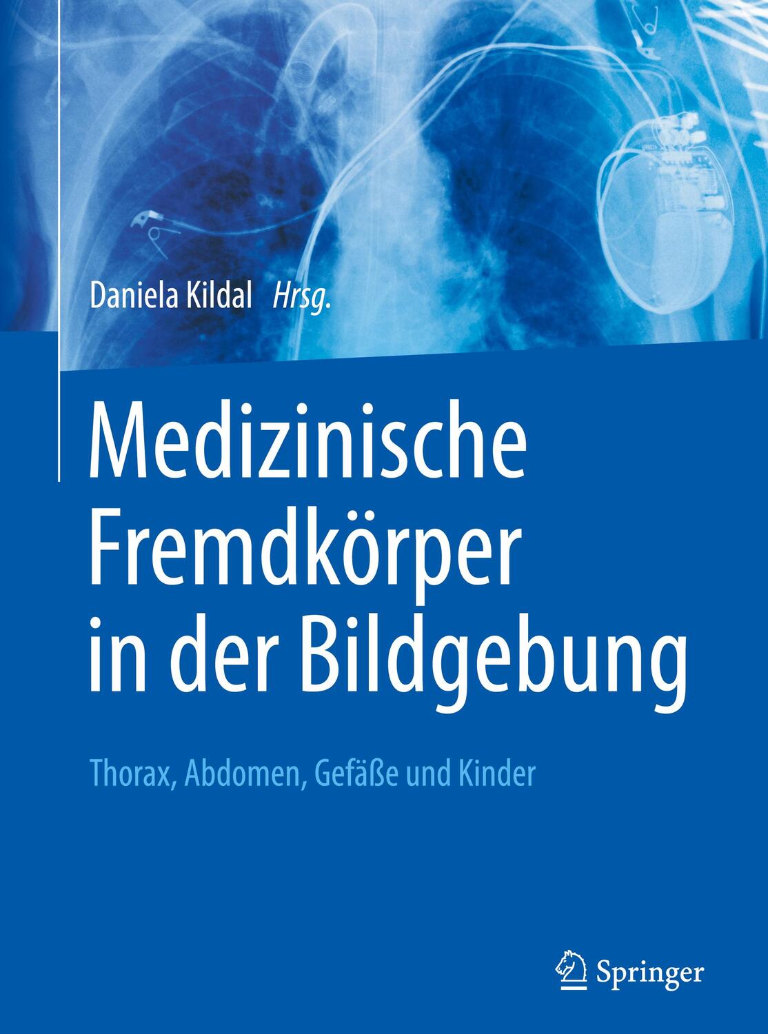 Cover: 9783662472958 | Medizinische Fremdkörper in der Bildgebung | Daniela Kildal | Buch