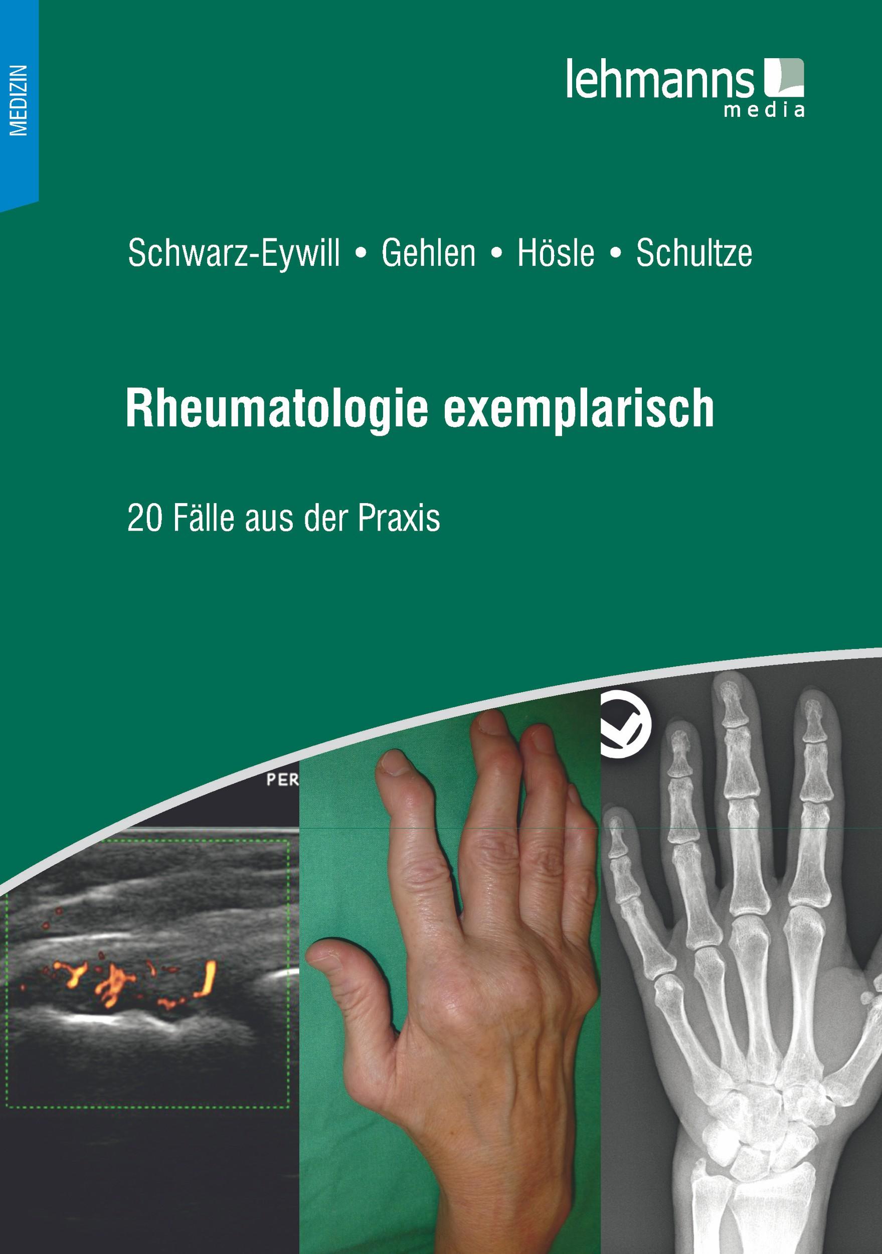 Cover: 9783965430624 | Rheumatologie exemplarisch | 20 Fälle aus der Praxis | Taschenbuch