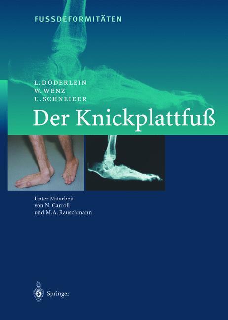 Cover: 9783642631573 | FussdeformitÄten | Der Knickplattfuss | L. Döderlein (u. a.) | Buch