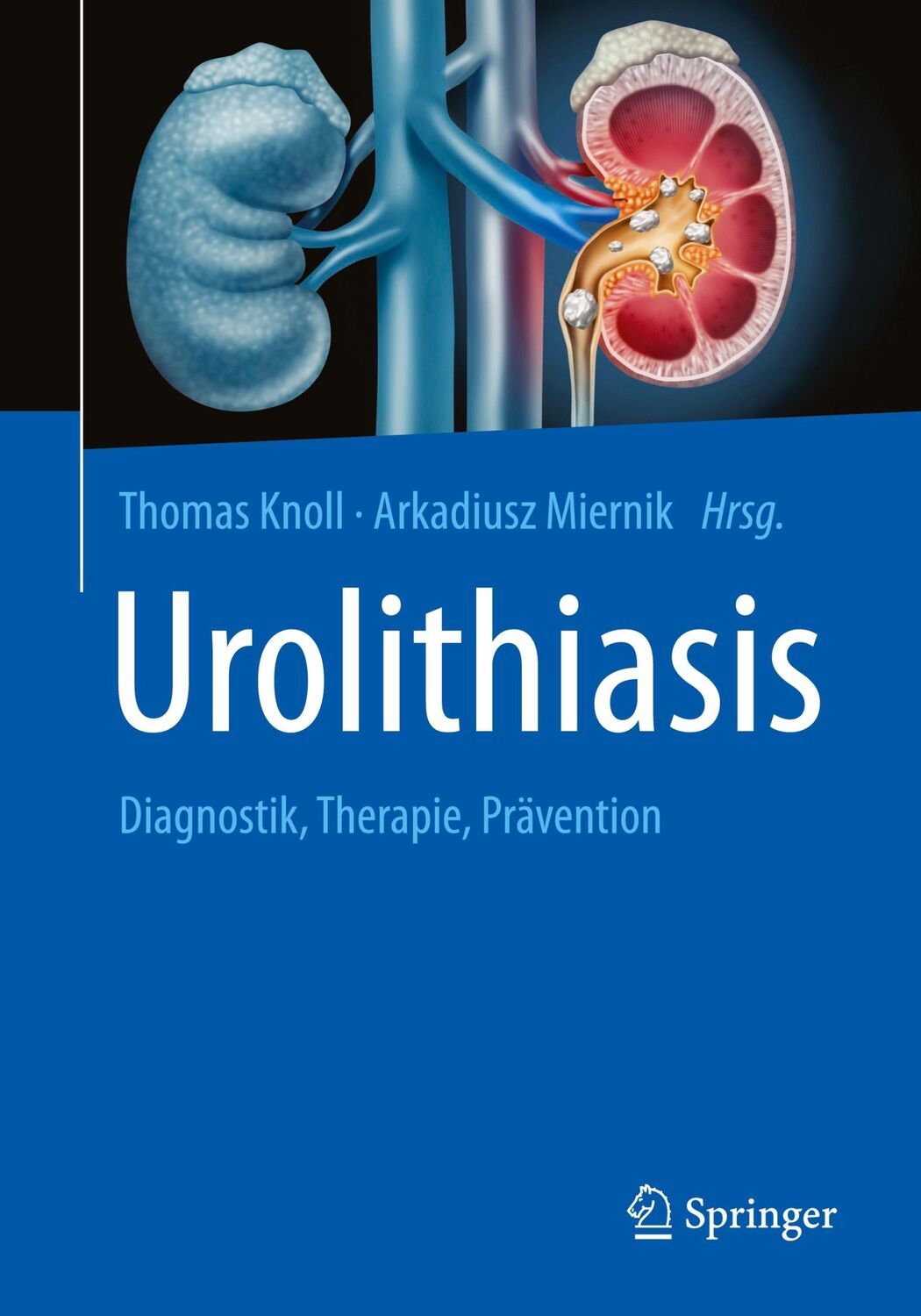 Cover: 9783662624531 | Urolithiasis | Diagnostik, Therapie, Prävention | Thomas Knoll (u. a.)