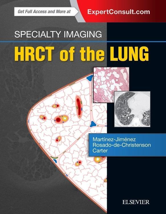 Cover: 9780323524773 | Specialty Imaging: HRCT of the Lung | Martinez-Jimenez (u. a.) | Buch