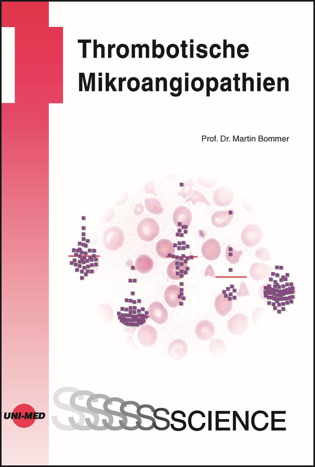 Cover: 9783837415933 | Thrombotische Mikroangiopathien | Martin Bommer | Buch | Deutsch