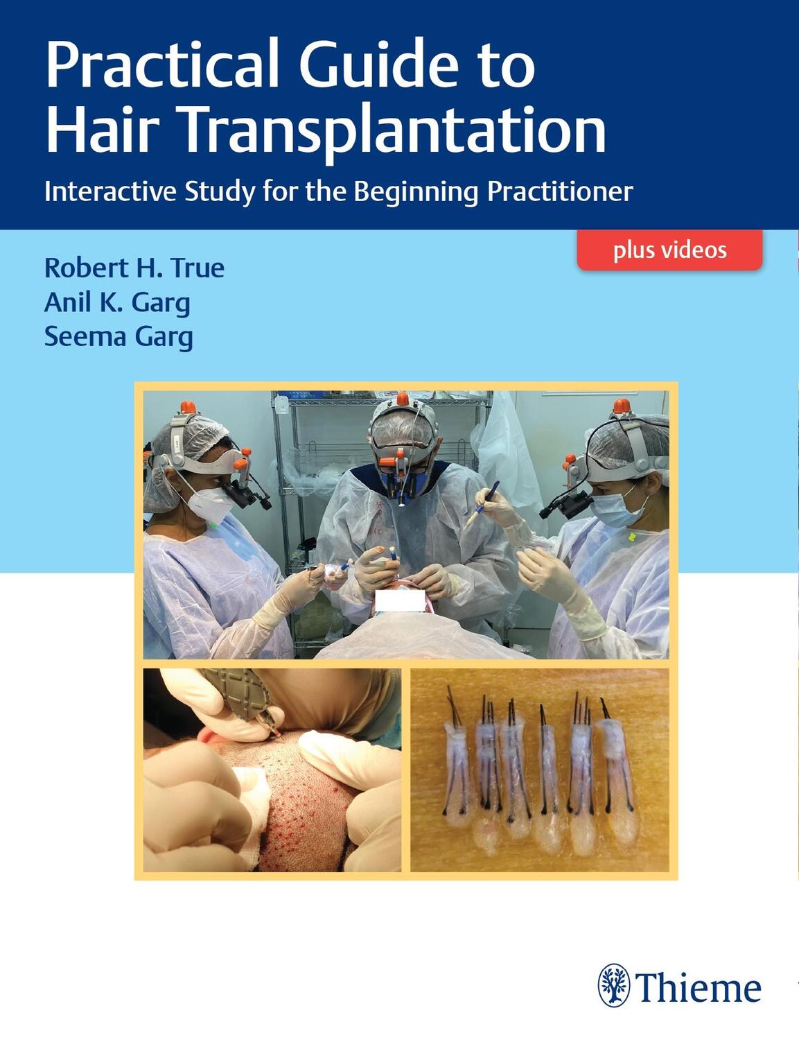 Cover: 9789390553242 | Practical Guide to Hair Transplantation | Robert True (u. a.) | Buch
