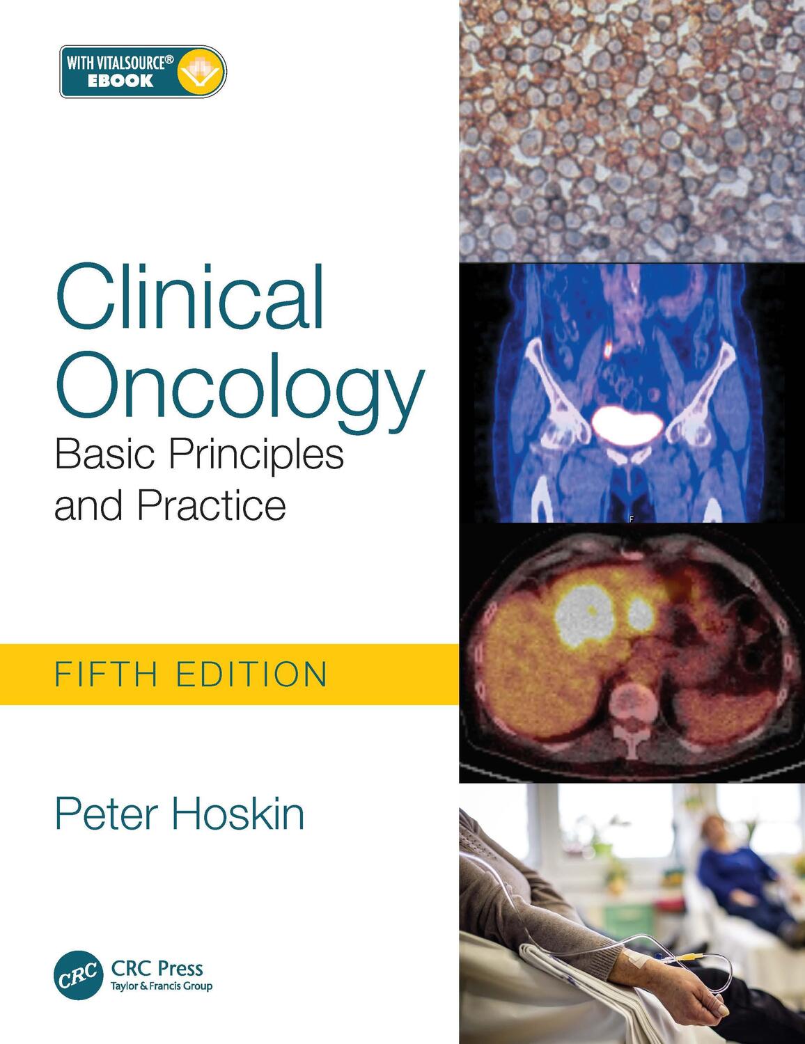 Cover: 9781138035553 | Clinical Oncology | Basic Principles and Practice | Peter Hoskin