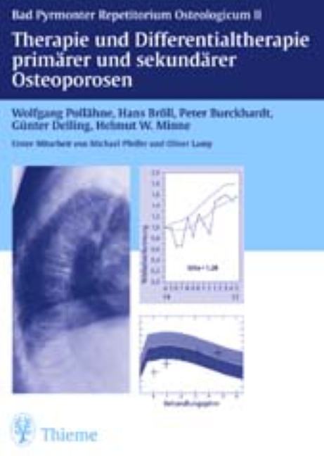 Cover: 9783131051516 | Therapie primärer und sekundärer Osteoporosen | Pollähne (u. a.)