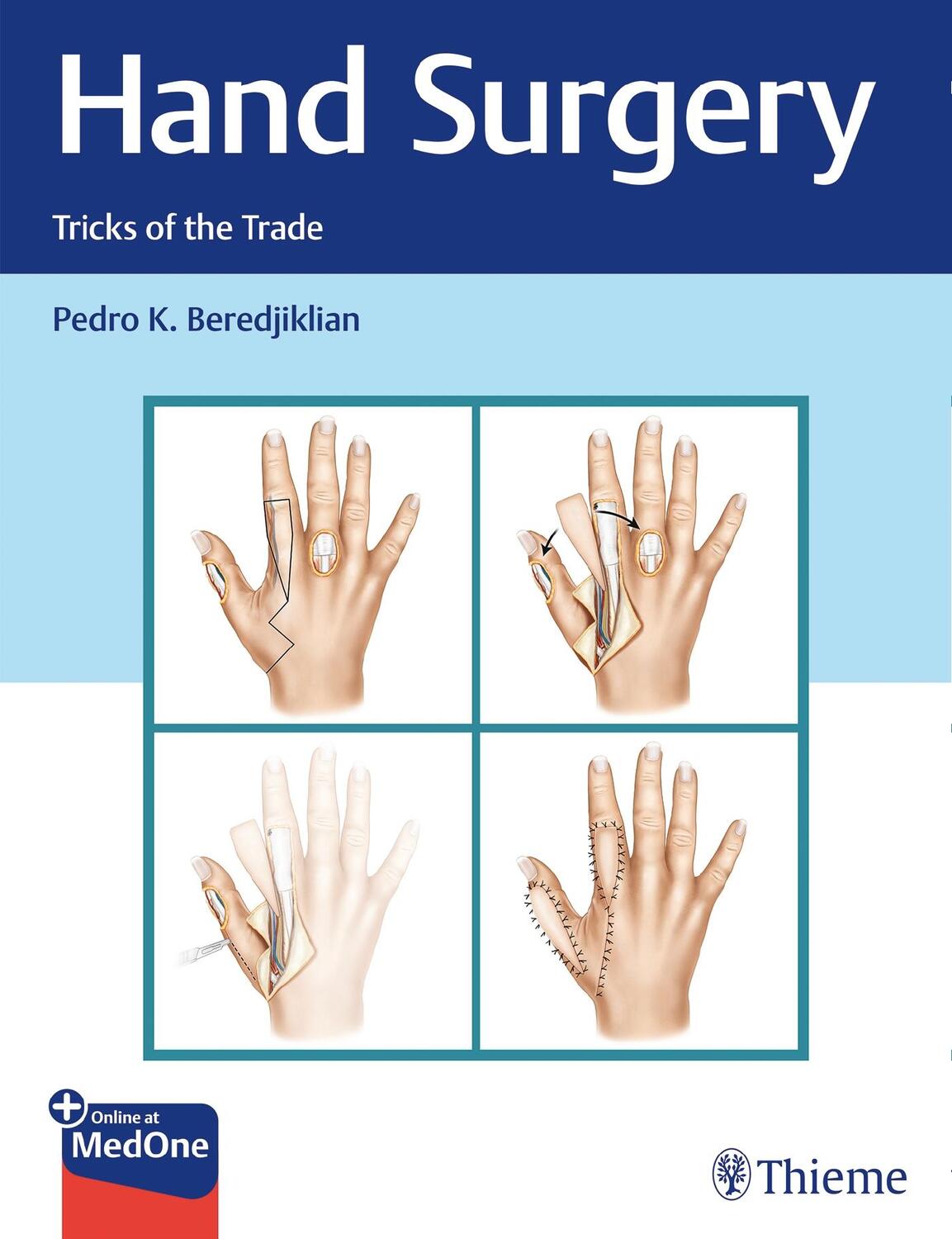 Cover: 9781626234796 | Hand Surgery | Tricks of the Trade | Pedro Beredjiklian | Bundle