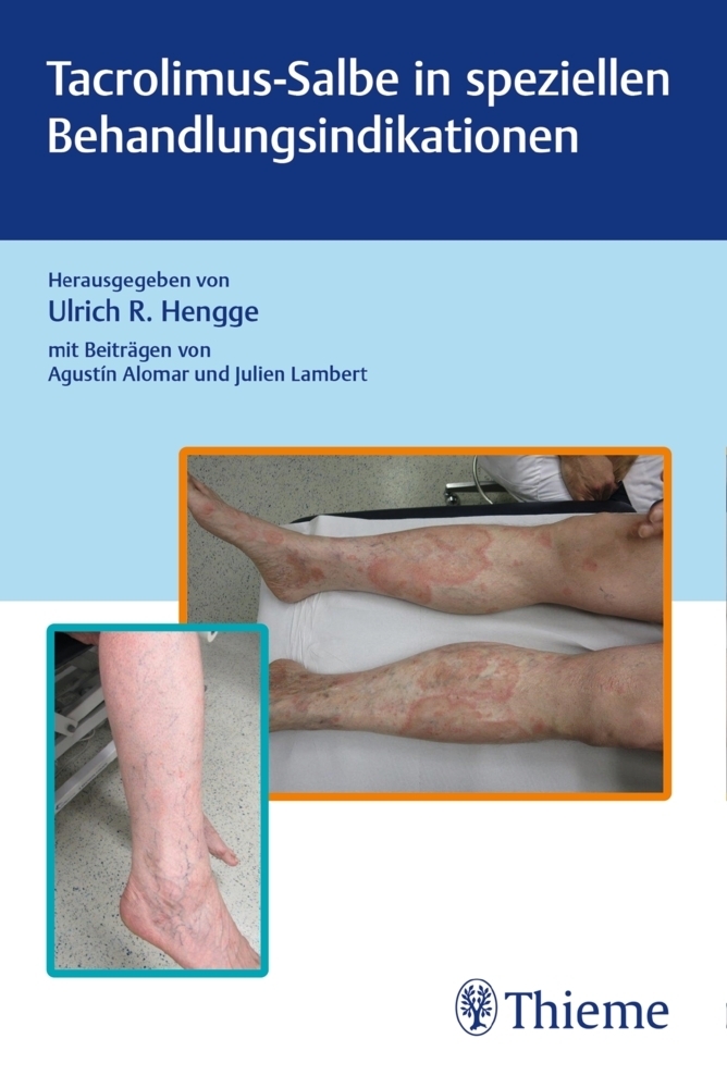 Cover: 9783132423756 | Tacrolimus-Salbe in speziellen Behandlungsindikationen | Hengge | Buch