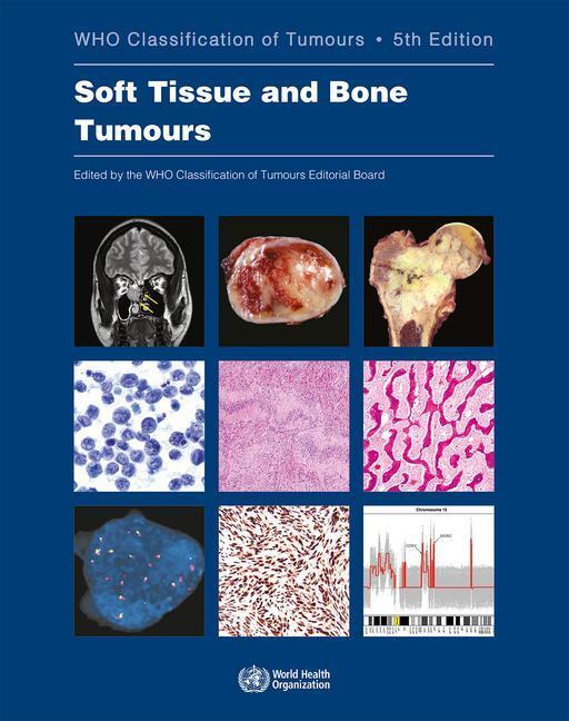 Cover: 9789283245025 | Soft Tissue and Bone Tumours | Who Classification of Tumours | Board