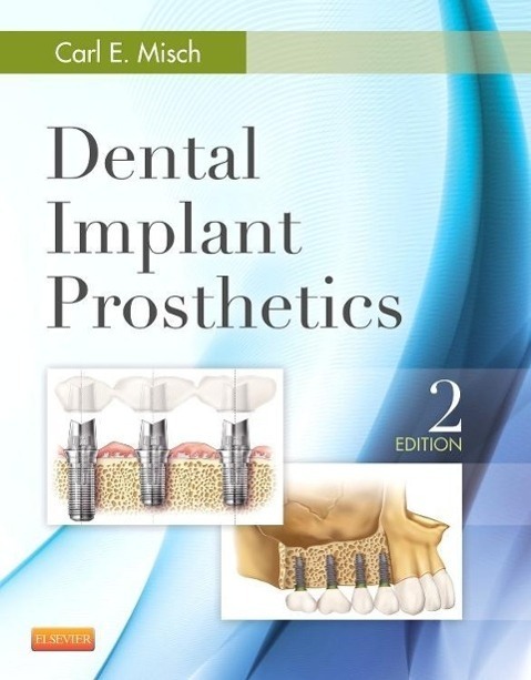 Cover: 9780323078450 | Dental Implant Prosthetics | Carl E. Misch | Buch | Gebunden | 2014