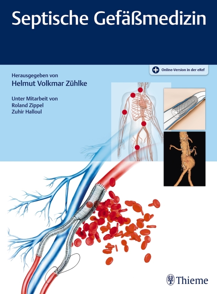 Cover: 9783132009813 | Septische Gefäßmedizin | Helmut V. Zühlke | Bundle | 1 Buch | 2019