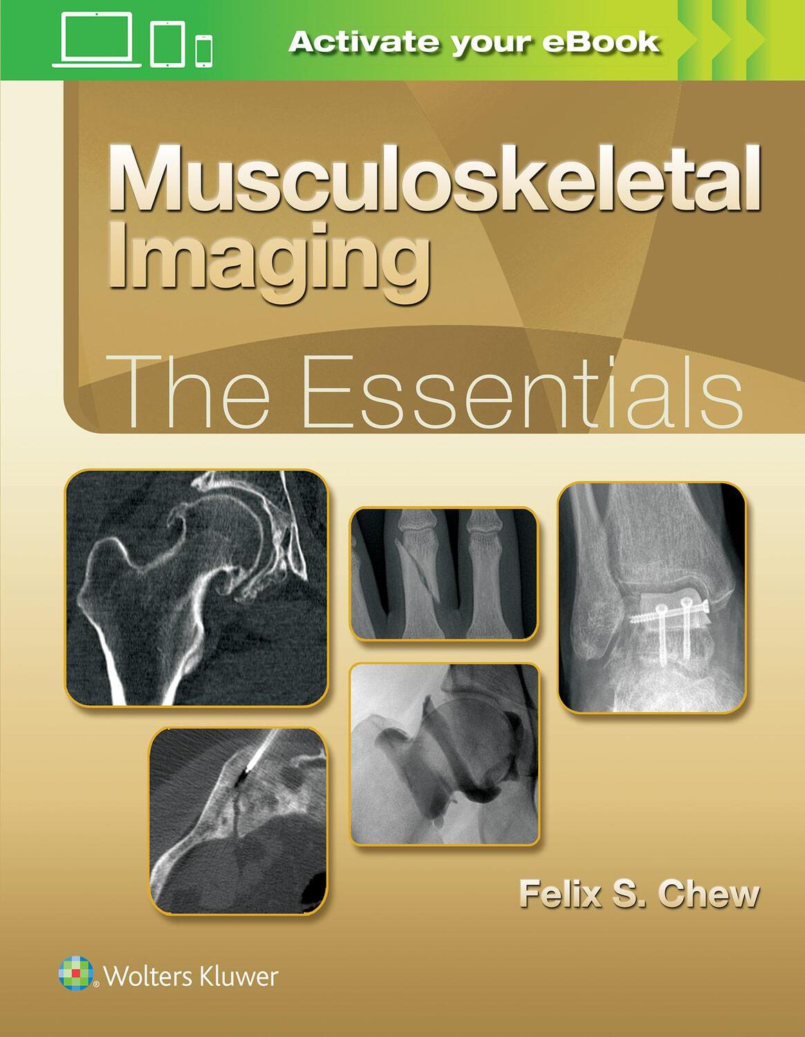 Cover: 9781496383839 | Musculoskeletal Imaging: The Essentials | Felix S. Chew | Buch | 2018
