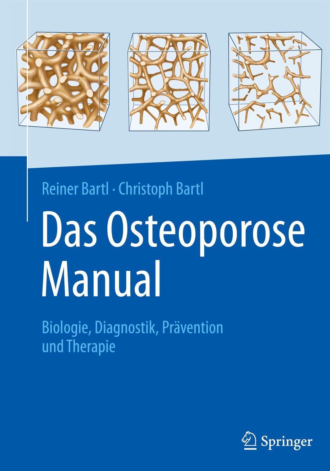 Cover: 9783662625279 | Das Osteoporose Manual | Biologie, Diagnostik, Prävention und Therapie