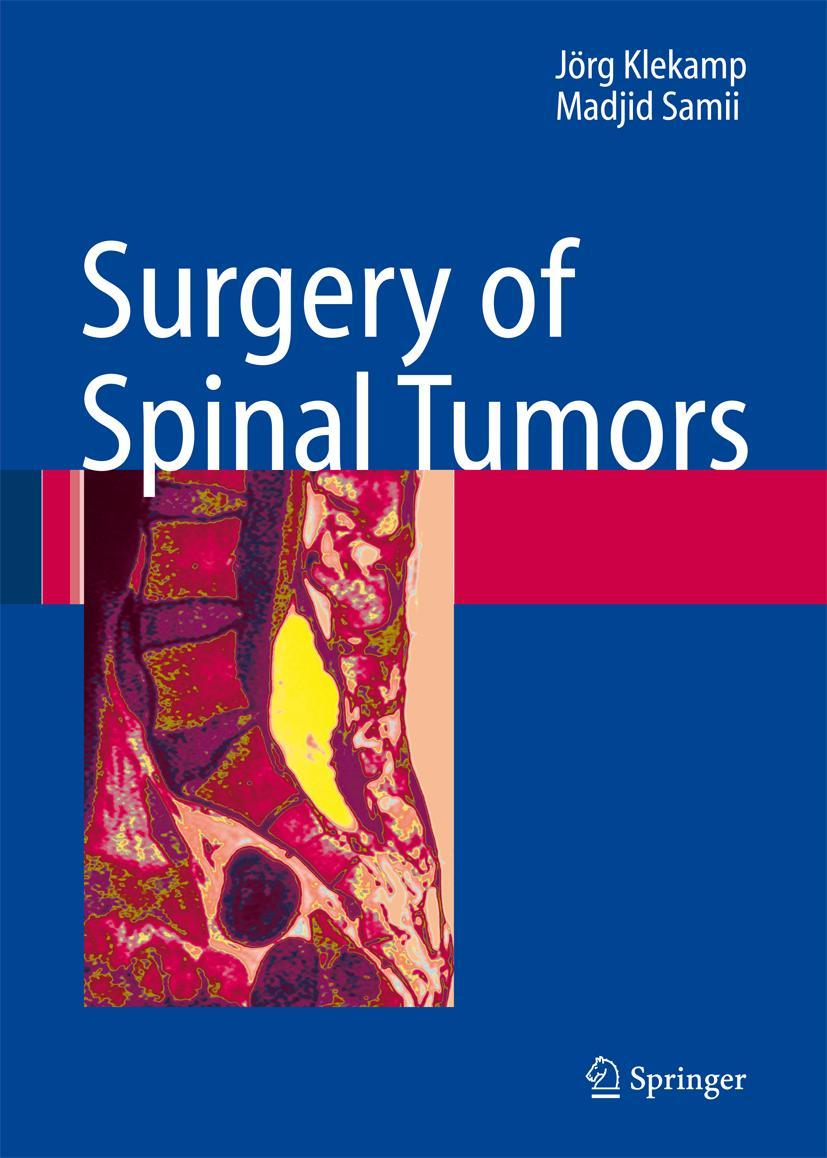 Cover: 9783642079481 | Surgery of Spinal Tumors | Madjid Samii (u. a.) | Taschenbuch | xviii