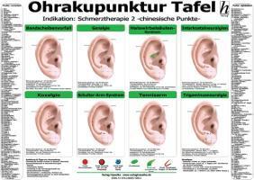 Cover: 9783869570693 | Ohrakupunktur Tafel - Indikation: Schmerztherapie 2 | Poster | Deutsch