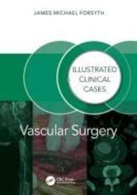 Cover: 9781032804811 | Vascular Surgery: | Illustrated Clinical Cases | James Forsyth | Buch