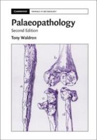 Cover: 9781108730884 | Palaeopathology | Tony Waldron | Taschenbuch | Kartoniert / Broschiert