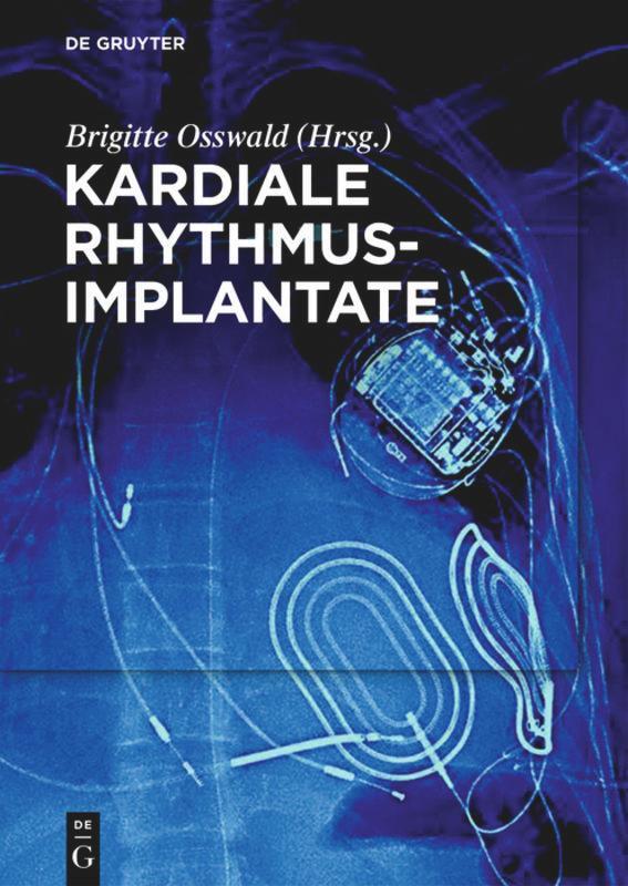 Cover: 9783110440461 | Kardiale Rhythmusimplantate | Brigitte Osswald | Taschenbuch | Deutsch