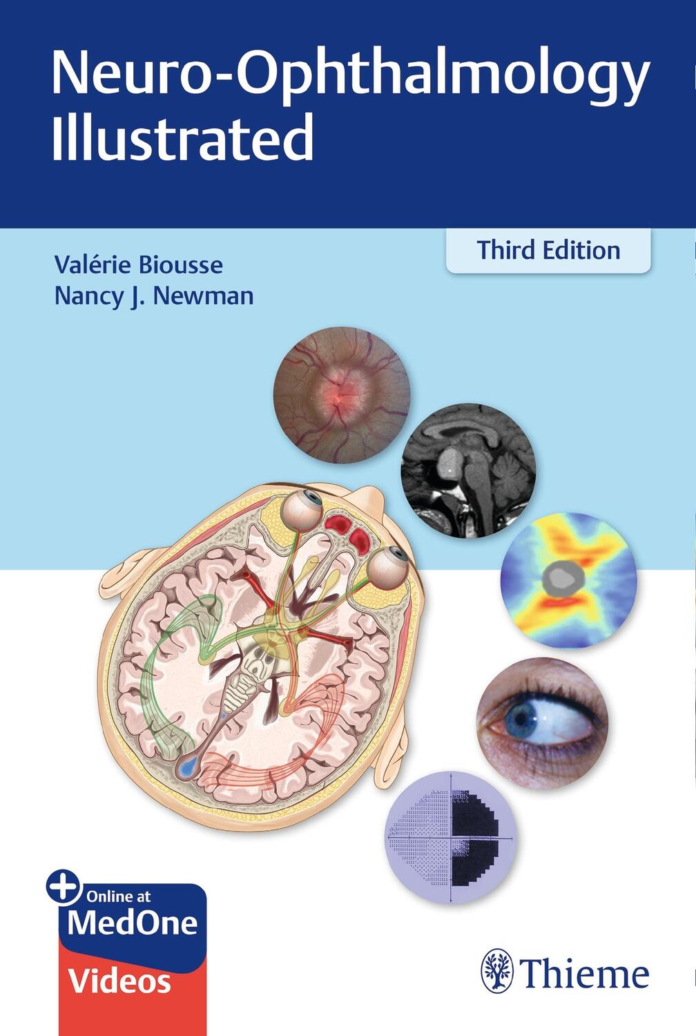 Cover: 9781684200740 | Neuro-Ophthalmology Illustrated | Valerie Biousse (u. a.) | Buch