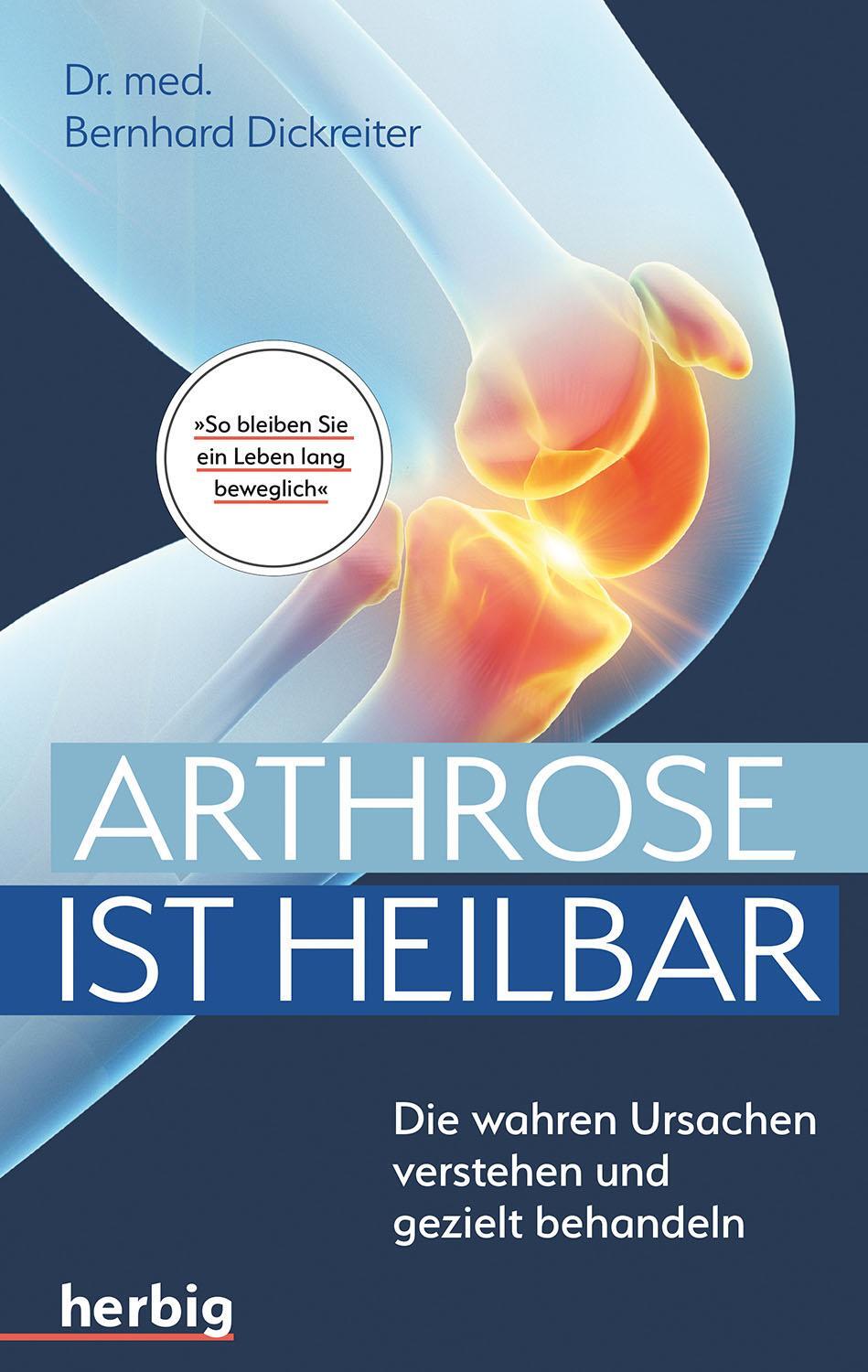 Cover: 9783968590127 | Arthrose ist heilbar | Bernhard Dickreiter | Taschenbuch | Deutsch