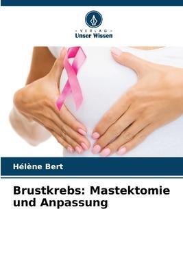 Cover: 9786206005254 | Brustkrebs: Mastektomie und Anpassung | Hélène Bert | Taschenbuch