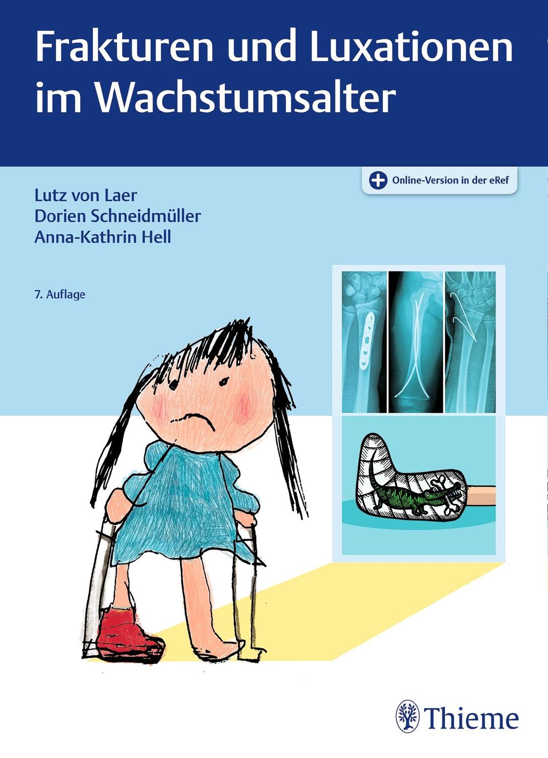 Cover: 9783132417564 | Frakturen und Luxationen im Wachstumsalter | Lutz von Laer (u. a.)