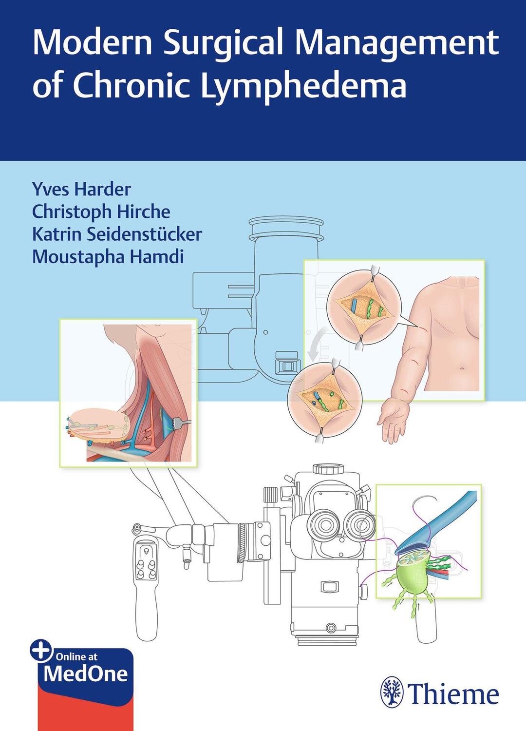 Cover: 9783132414280 | Modern Surgical Management of Chronic Lymphedema | Yves Harder (u. a.)