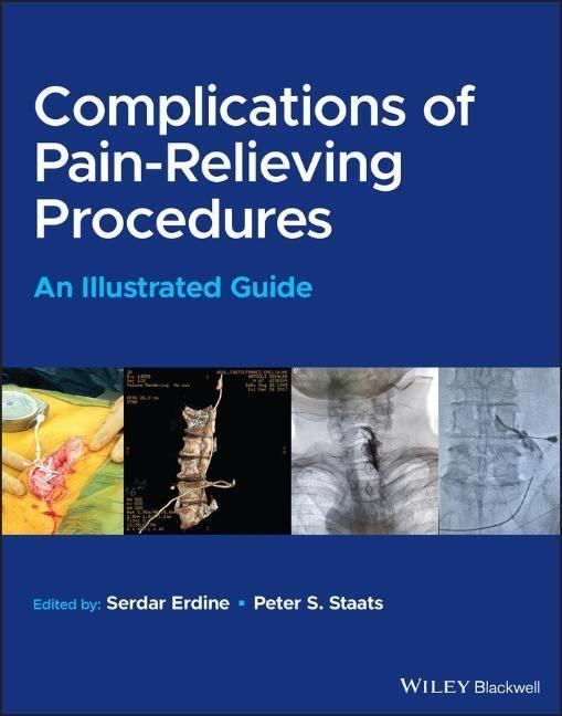 Cover: 9781119757276 | Complications of Pain-Relieving Procedures | An Illustrated Guide