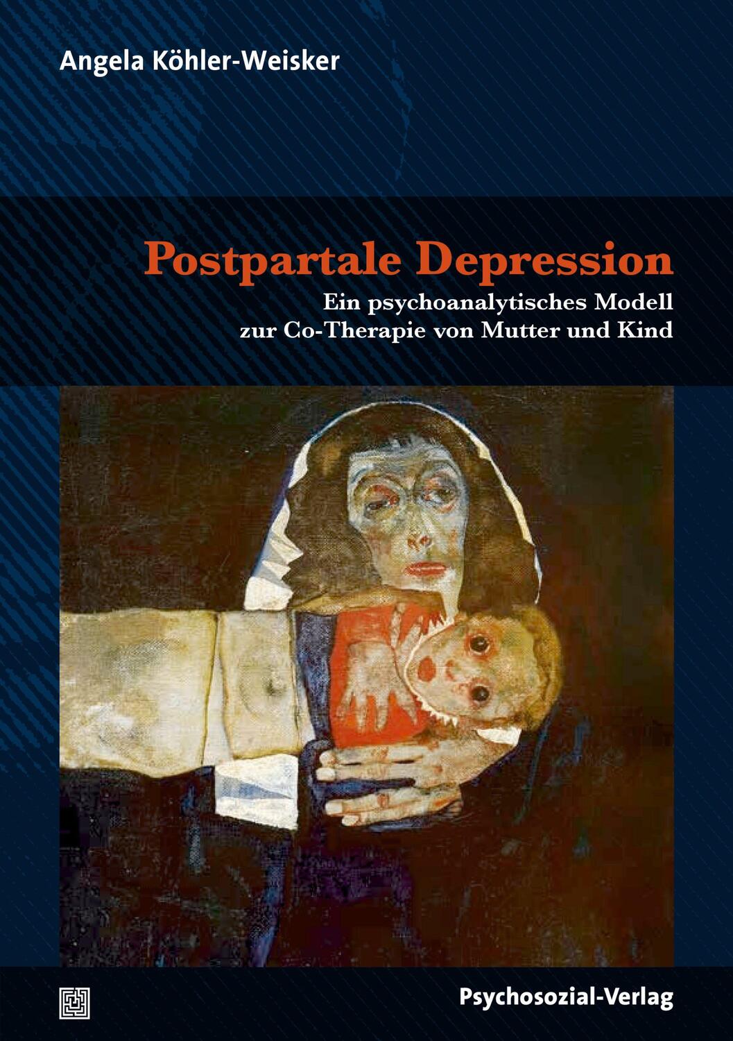 Cover: 9783837932676 | Postpartale Depression | Angela Köhler-Weisker | Taschenbuch | 234 S.