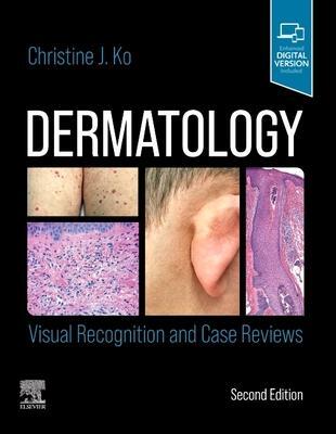 Cover: 9780323697255 | Dermatology: Visual Recognition and Case Reviews | Christine Ko | Buch