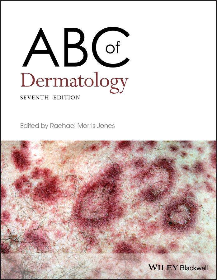 Cover: 9781119488989 | ABC of Dermatology | Rachael Morris-Jones | Taschenbuch | 280 S.