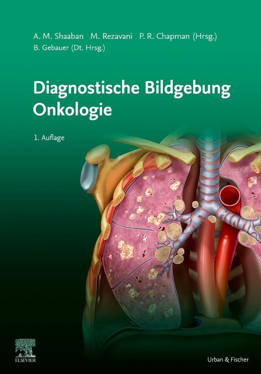 Cover: 9783437240317 | Diagnostische Bildgebung Onkologie | Bernhard Gebauer | Buch | Deutsch