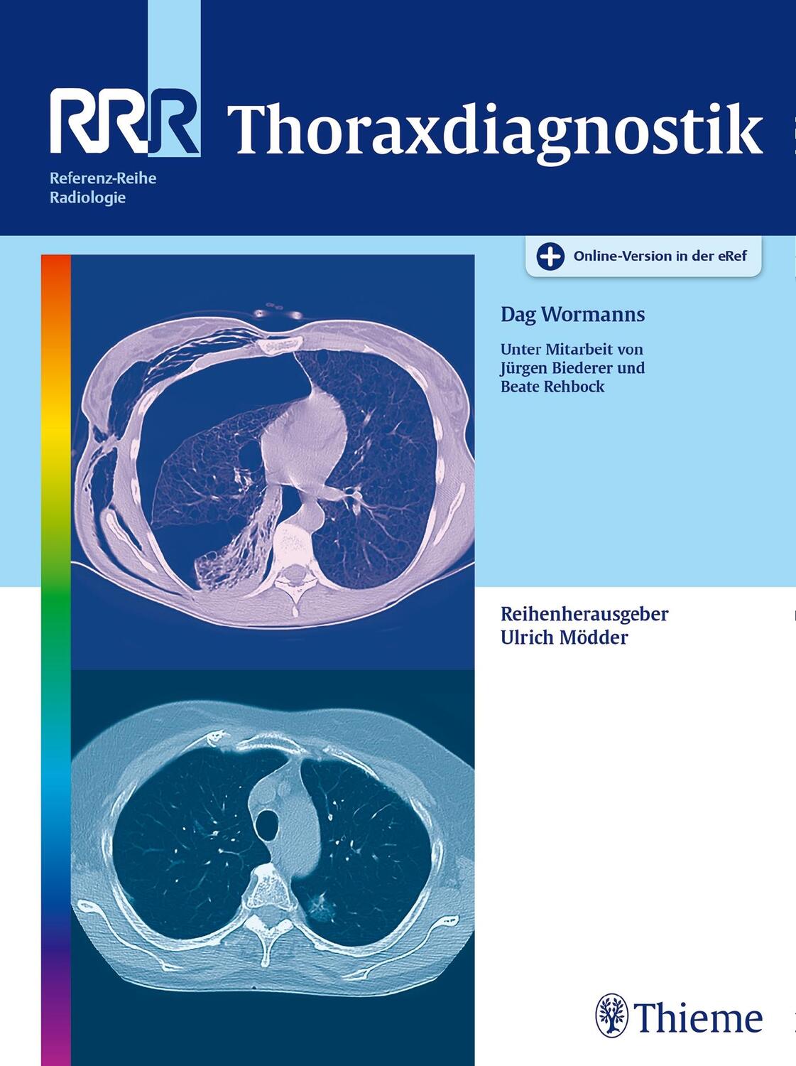 Cover: 9783131695918 | Thoraxdiagnostik | Dag Wormanns | Bundle | Referenzreihe Radiologie