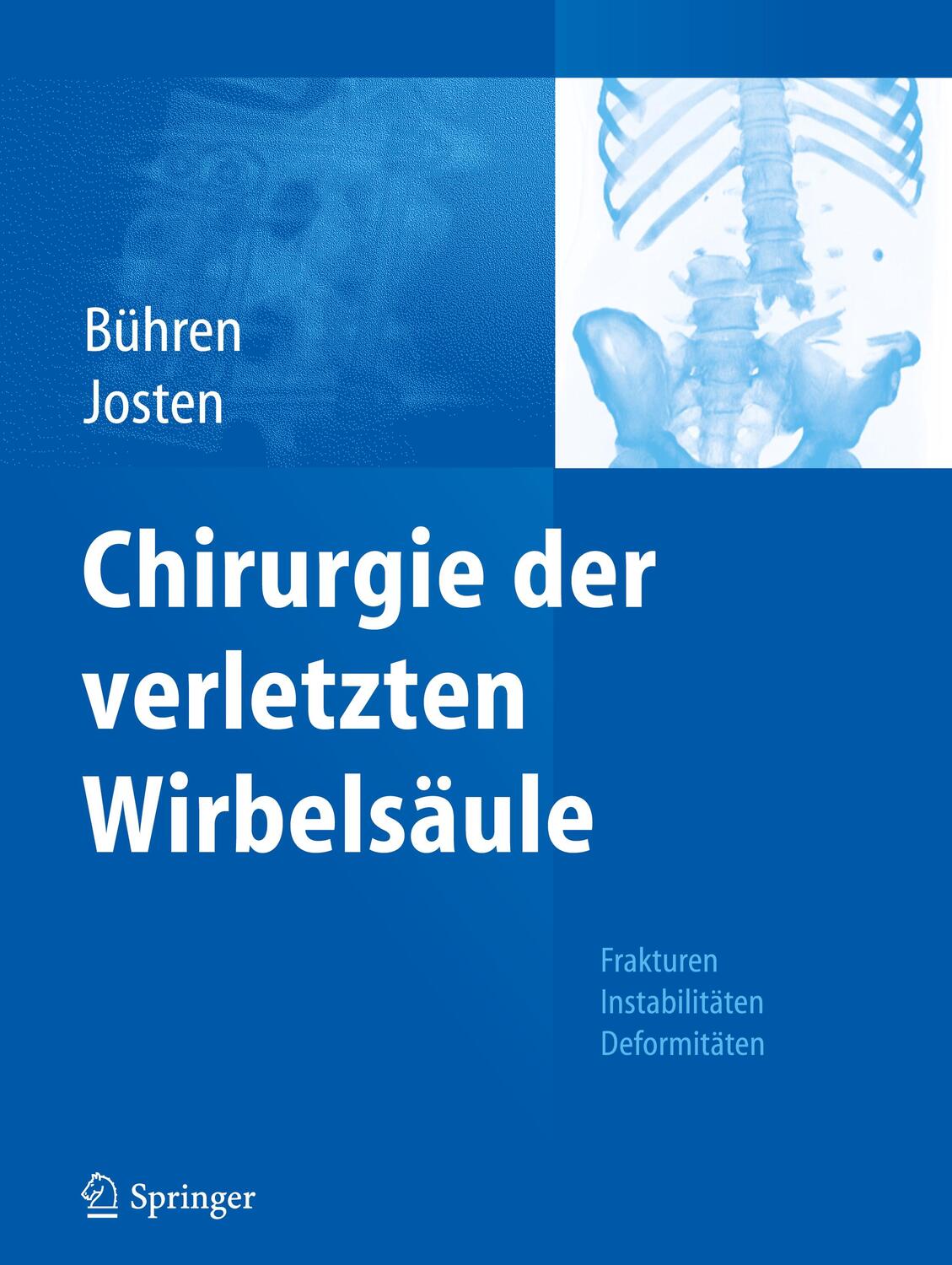 Cover: 9783642022074 | Chirurgie der verletzten Wirbelsäule | Christoph Josten (u. a.) | Buch