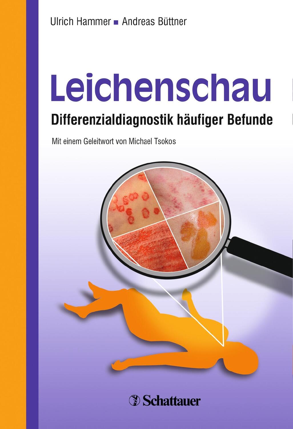 Cover: 9783794529643 | Leichenschau | Differenzialdiagnostik häufiger Befunde | Buch | 2013