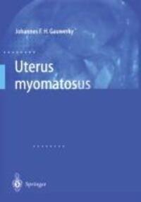 Cover: 9783642631399 | Uterus myomatosus | Johannes F.H. Gauwerky | Taschenbuch | Springer