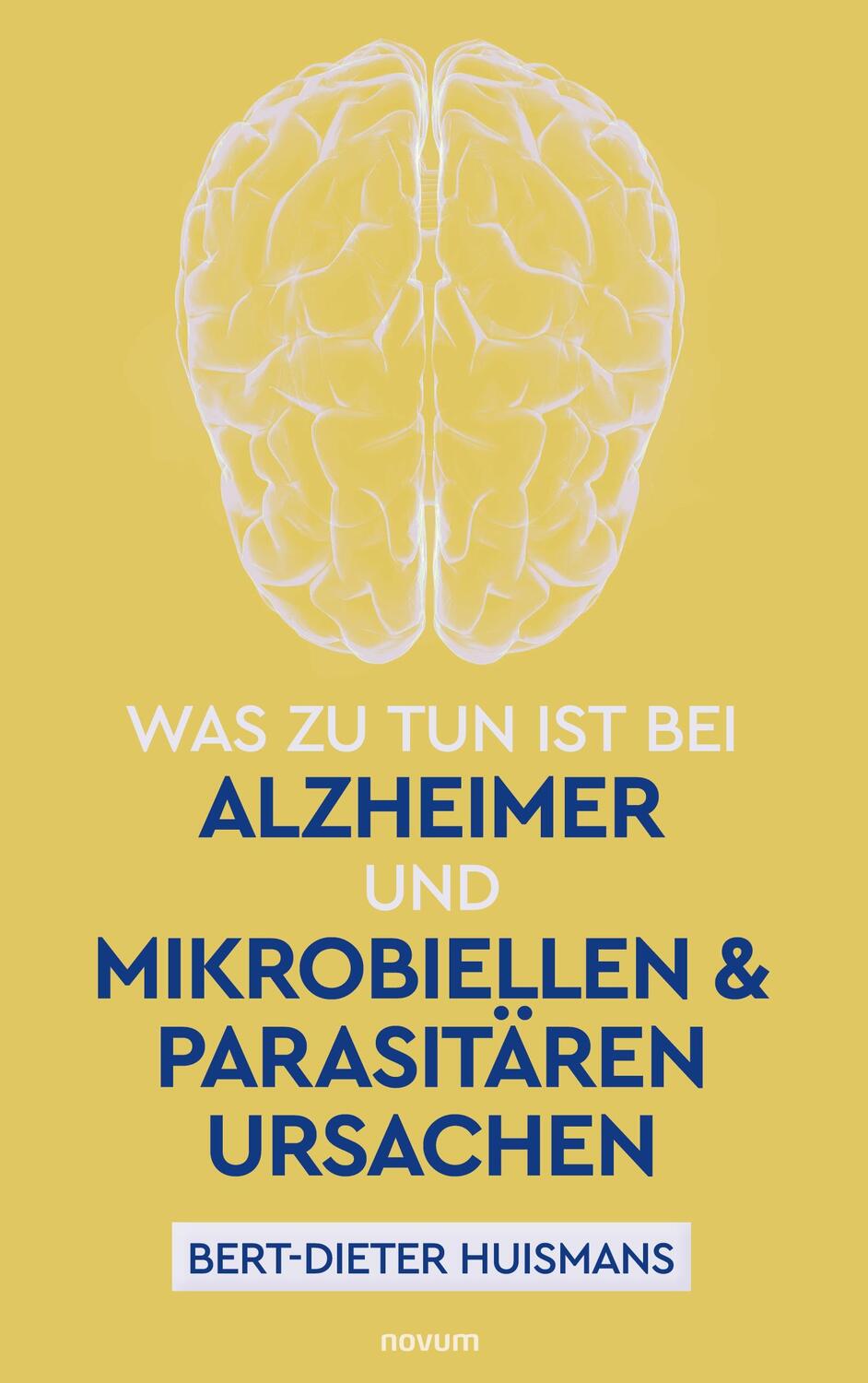 Cover: 9783991313069 | Was zu tun ist bei Alzheimer und mikrobiellen & parasitären Ursachen