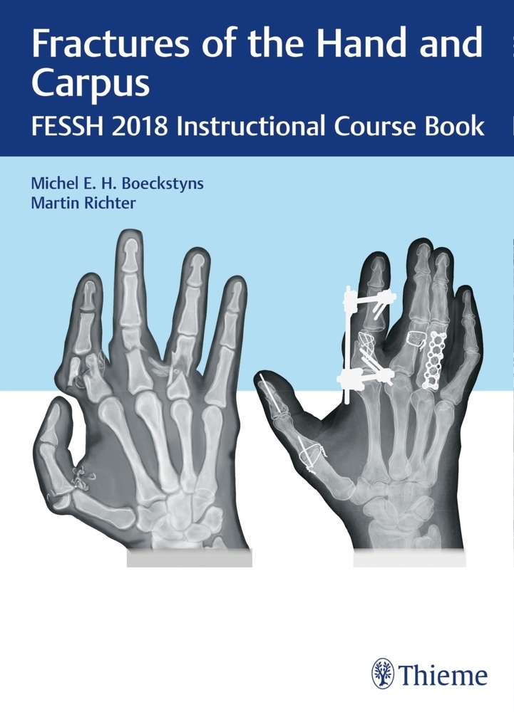 Cover: 9783132417205 | Fractures of the Hand and Carpus | Michel E.H. Boeckstyns (u. a.)