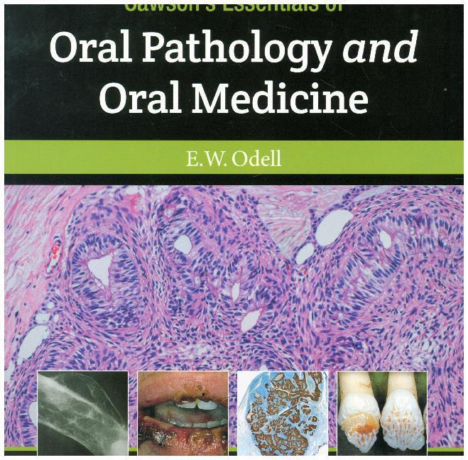 Cover: 9780702049828 | Cawson's Essentials of Oral Pathology and Oral Medicine | Odell | Buch