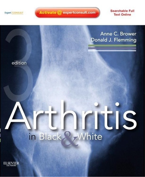 Cover: 9781416055952 | Arthritis in Black and White | Expert Consult - Online and Print