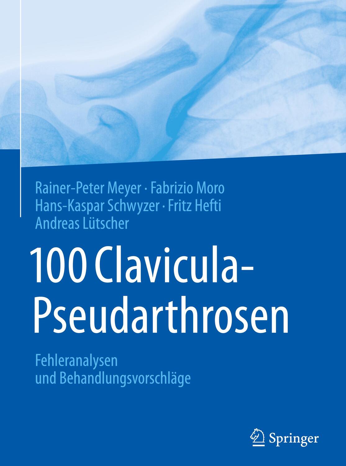 Cover: 9783662553442 | 100 Clavicula-Pseudarthrosen | Rainer-Peter Meyer (u. a.) | Buch